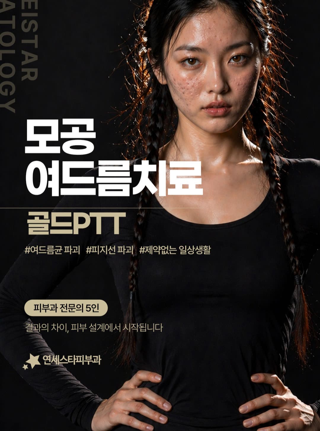 ✨ 모공과 여드름은