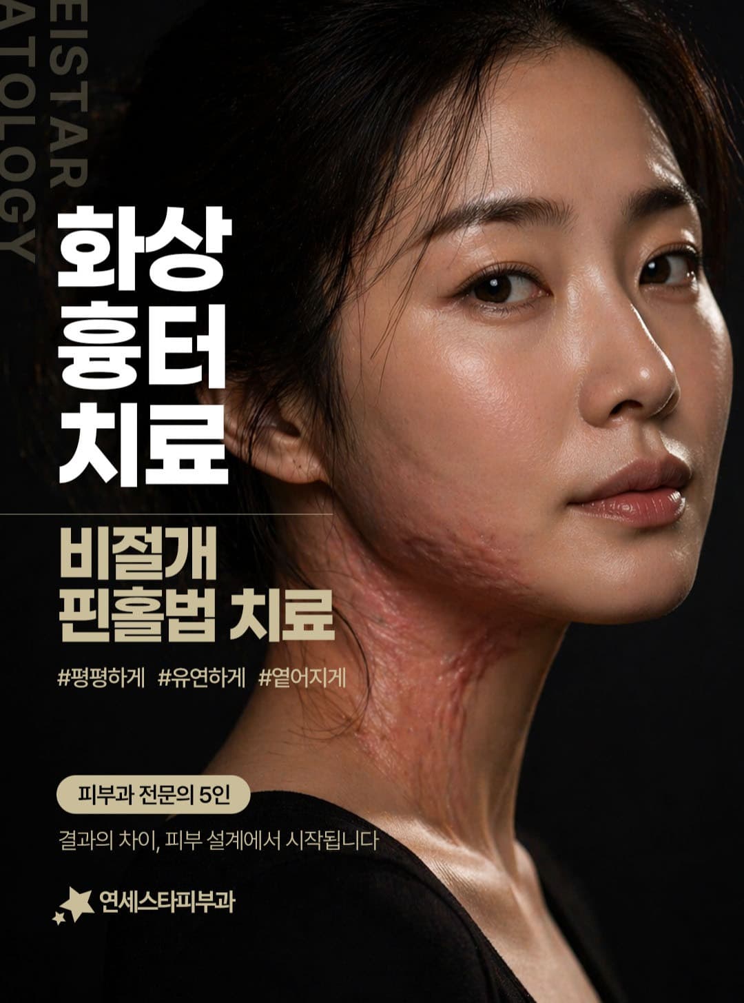 ✨ 화상 흉터는 단순히 옅어지는 것이 아니라