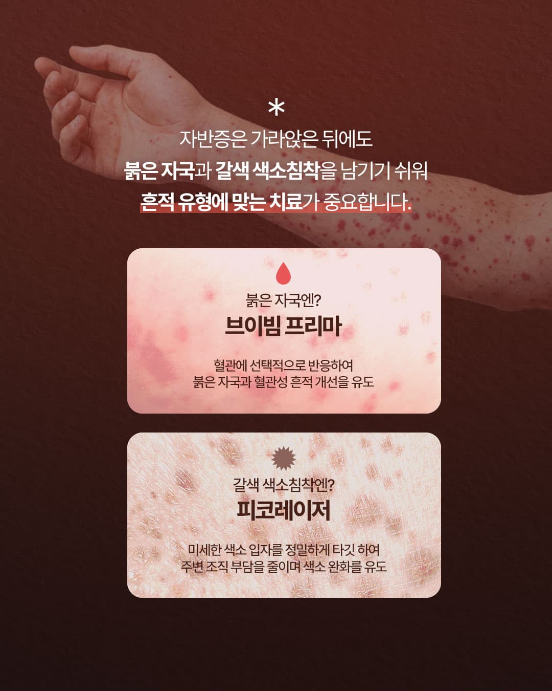 자반증은 가라앉은 뒤에도