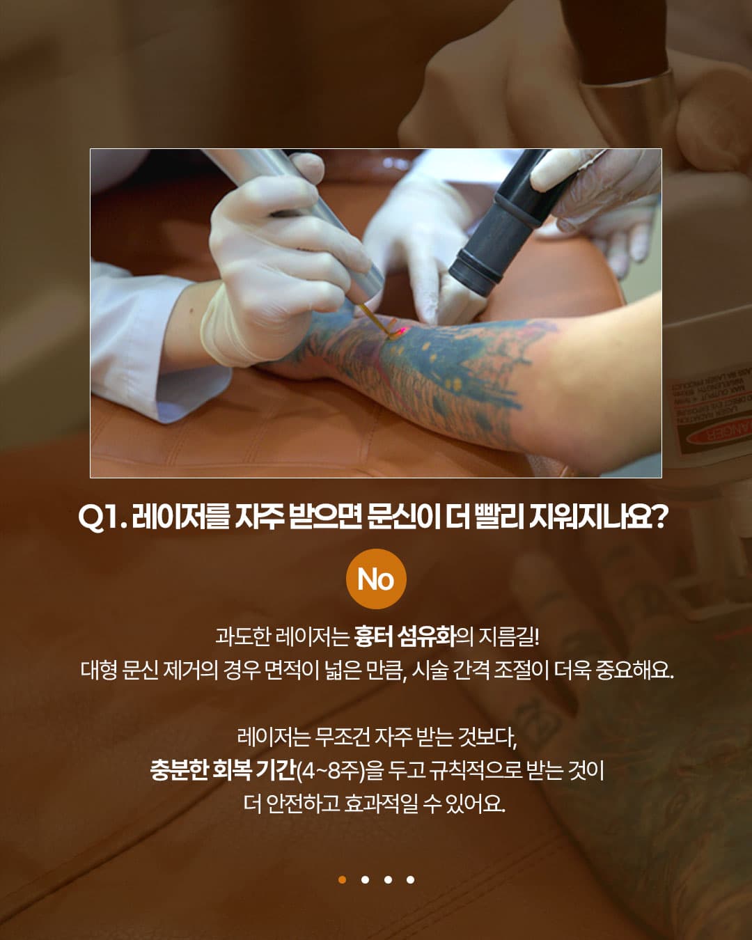 ✨ 刺青除去の疑問 Q&A ✨