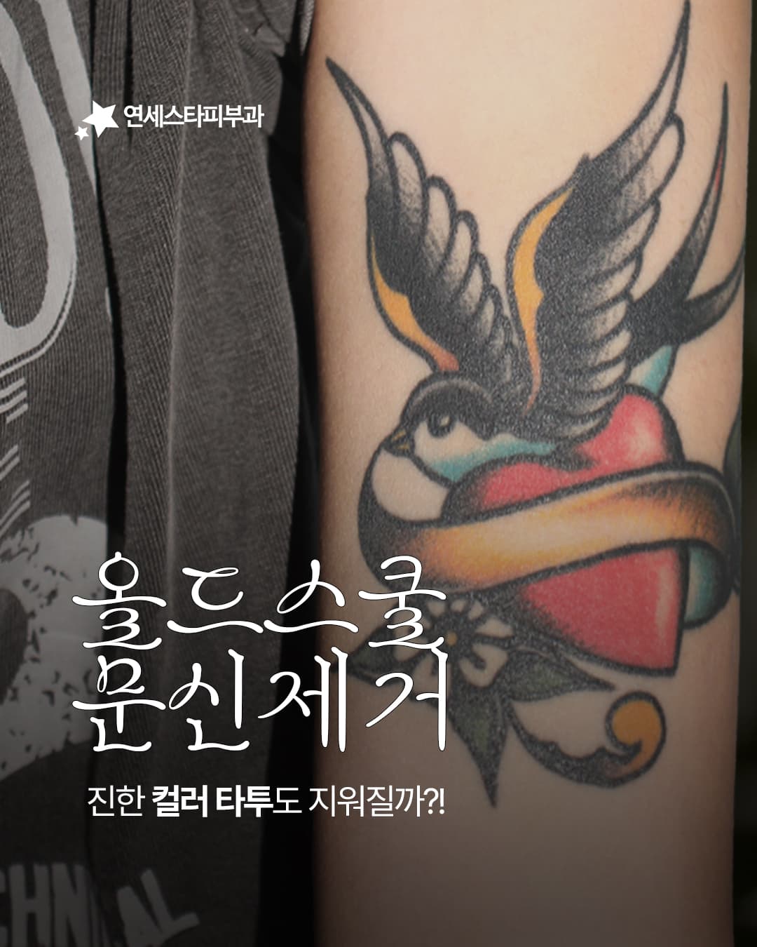 ✒️ 컬러 타투도 깨끗하게 지울 수 있을까요?!