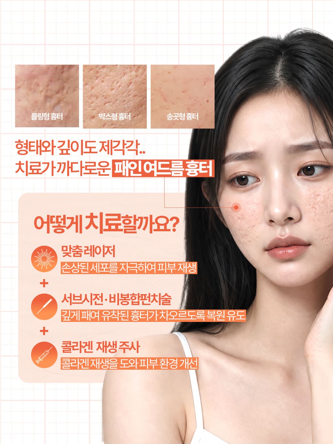 형태도, 깊이도 제각각인 여드름 흉터를