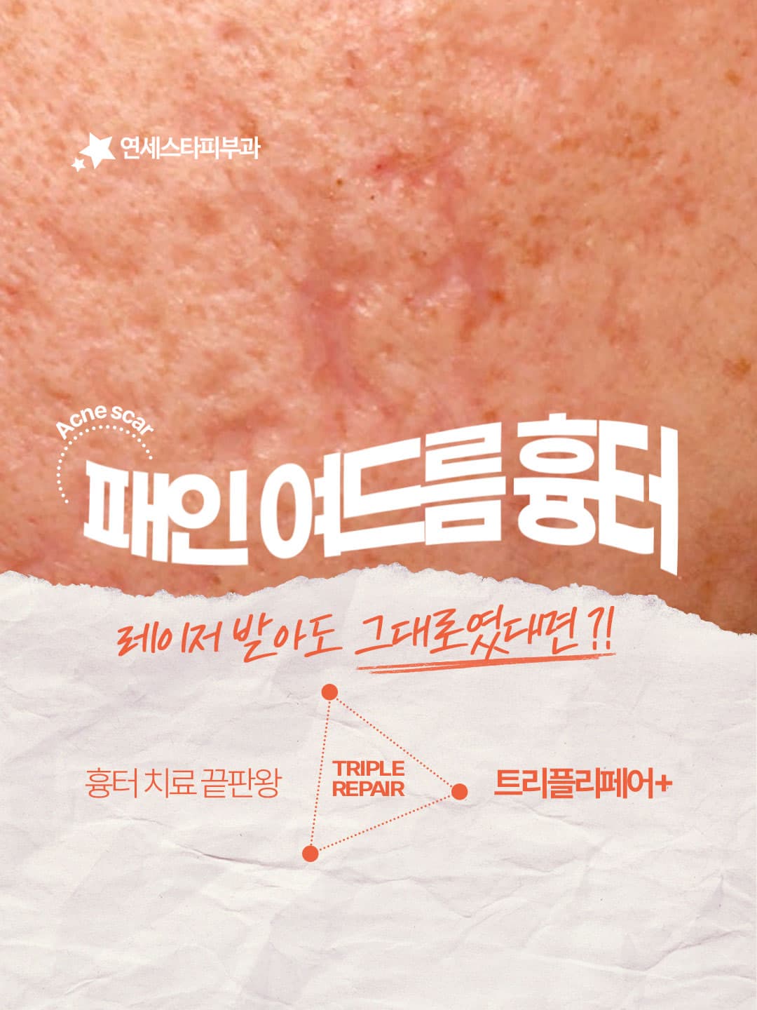 ⚠️시술 결과는 개인의 피부 상태 및