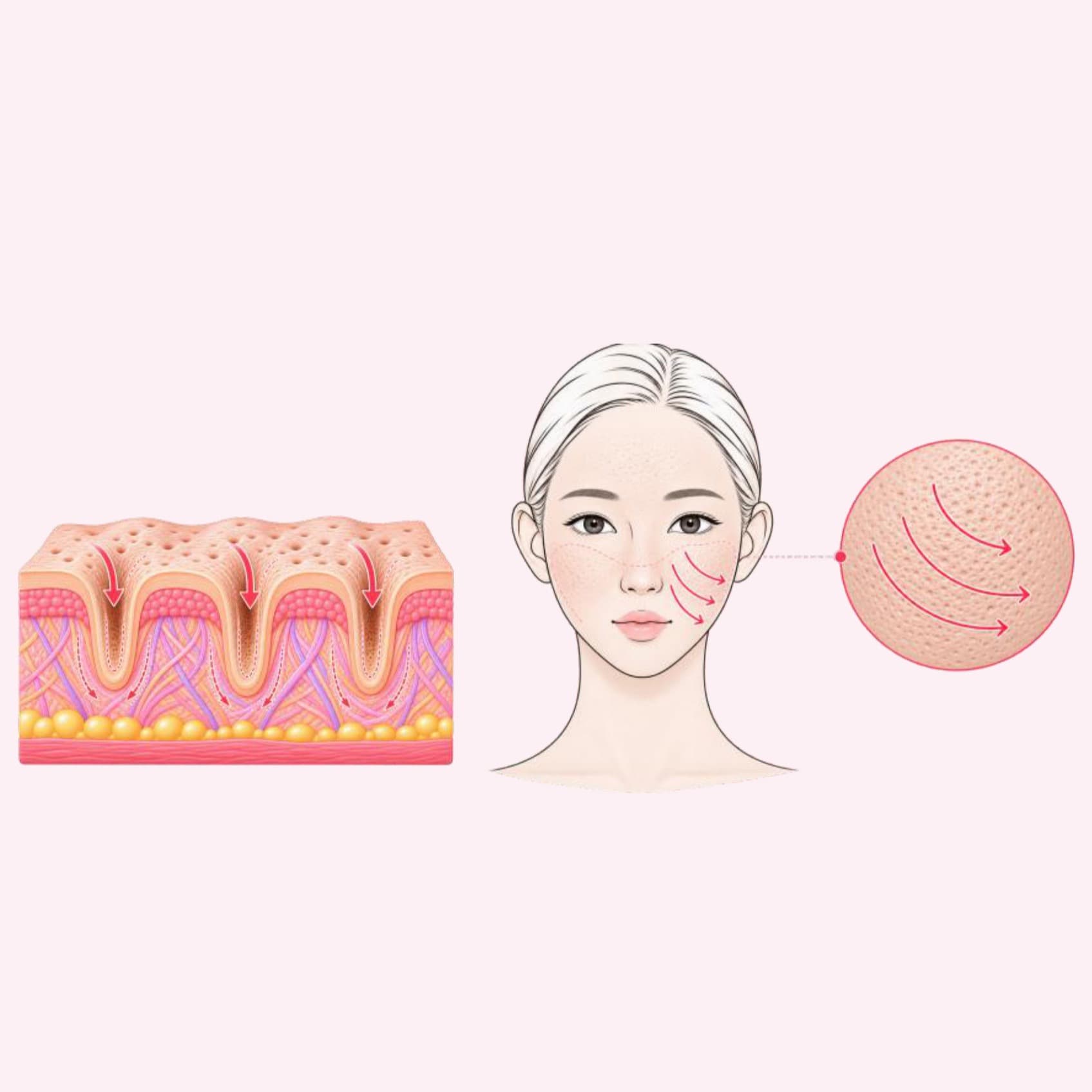 늘어진 모공과 거친 피부결을 매끄럽게