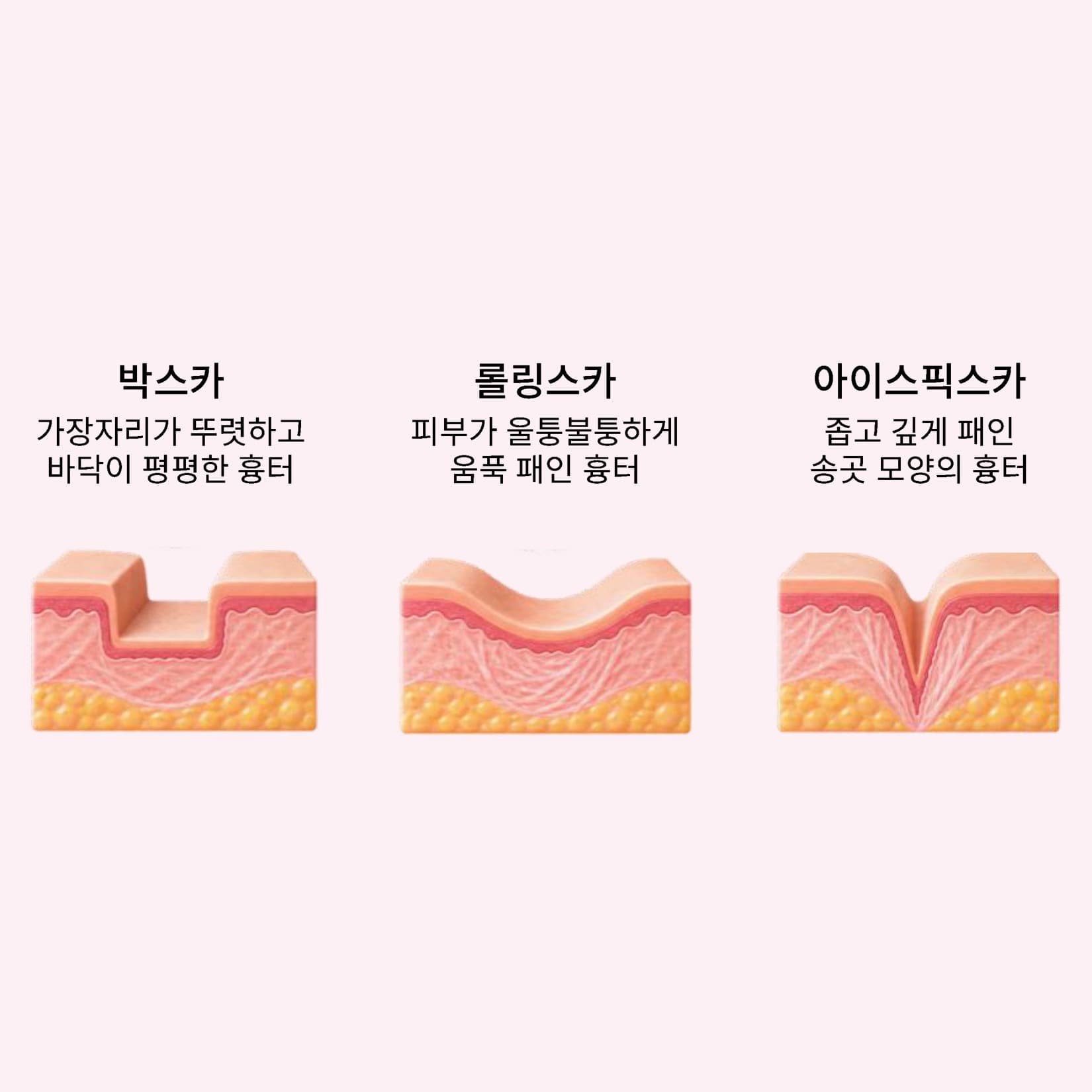 깊게 패인 흉터에 새살이 차오르게