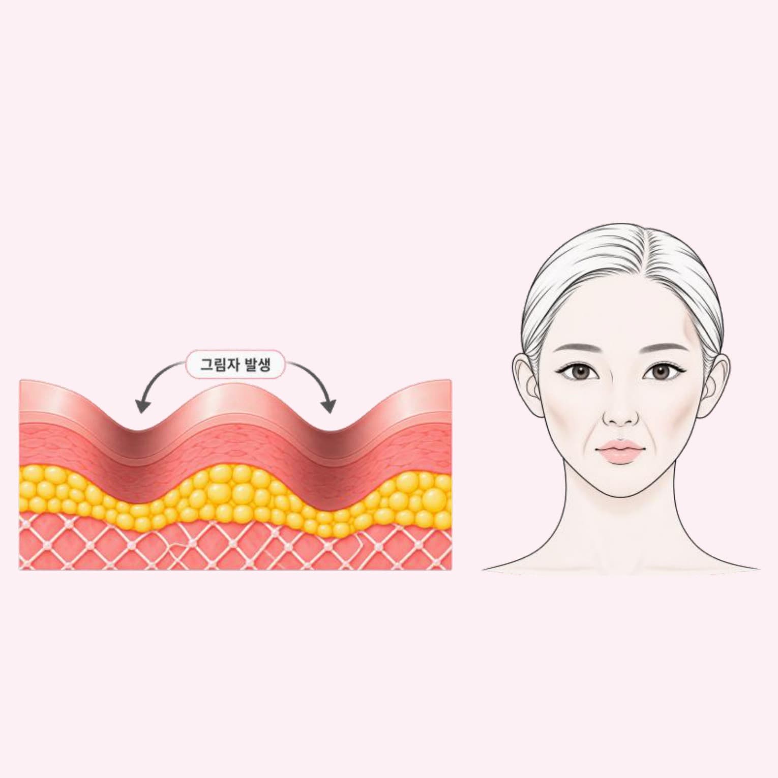 꺼진 피부에 자연스러운 볼륨과 탄력