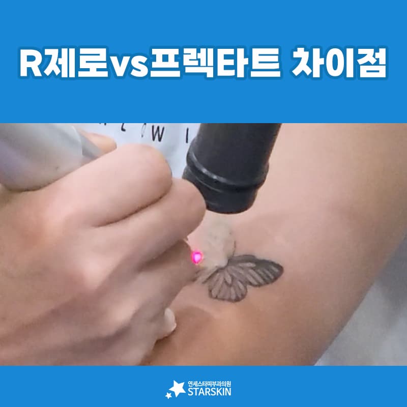 프렉타트와 R제로, 하얀 버블을 비켜 가는 두 가지 방식