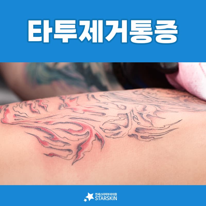 마취 방법에 따라 달라지는 준비 시간과 귀가 시간