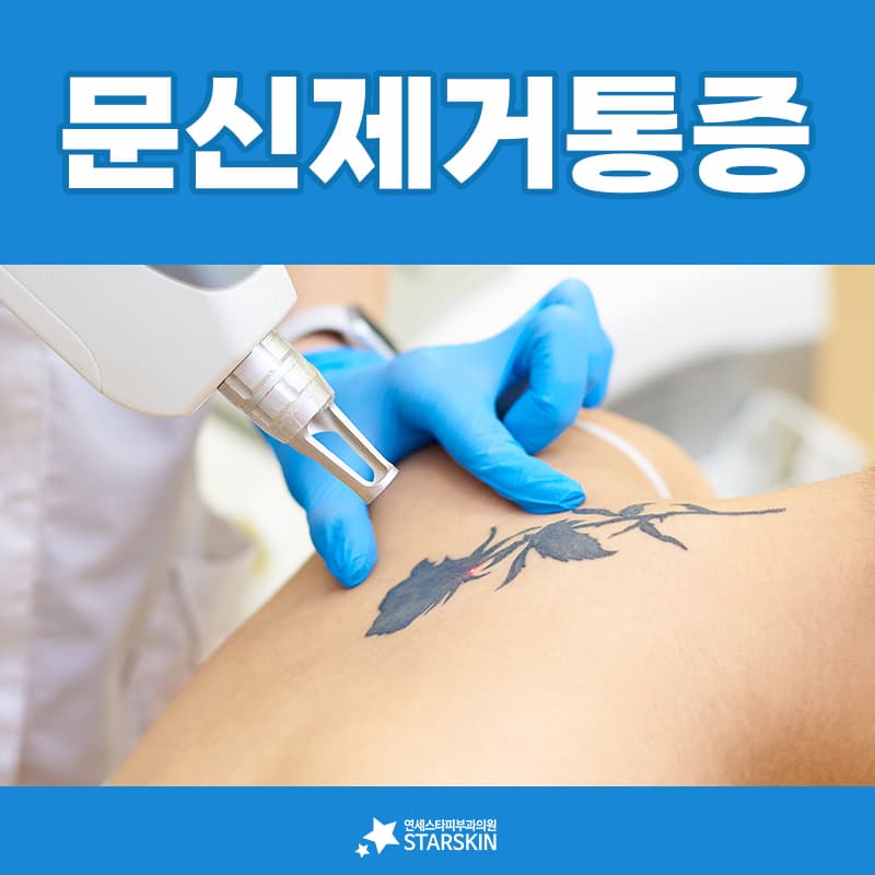 통증이 유독 크게 느껴지는 문신의 조건