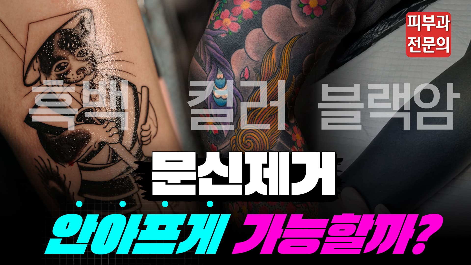 문신제거는 왜 아프고 수면마취는 왜 앞세우지 않나