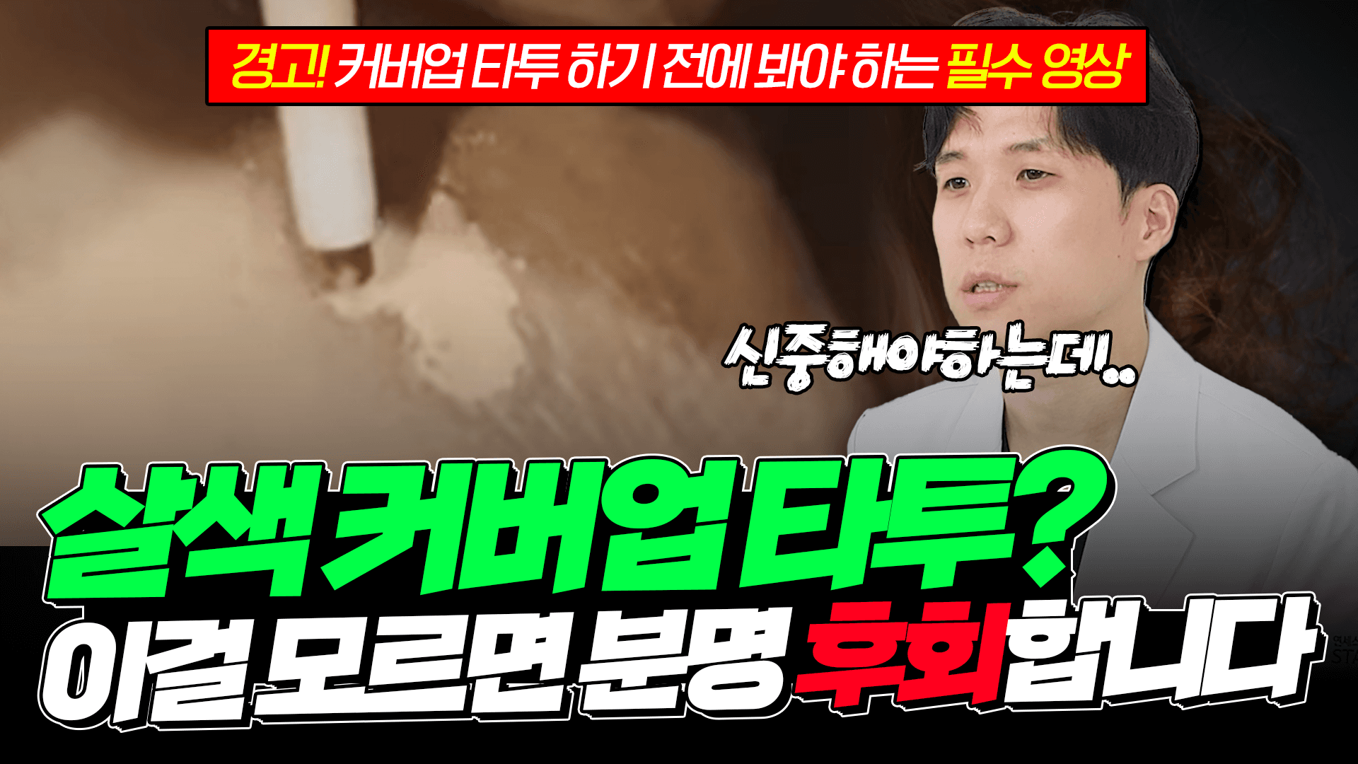 살색 커버업 타투가 지우기 가장 오래 걸리는 문신이 되는 과정