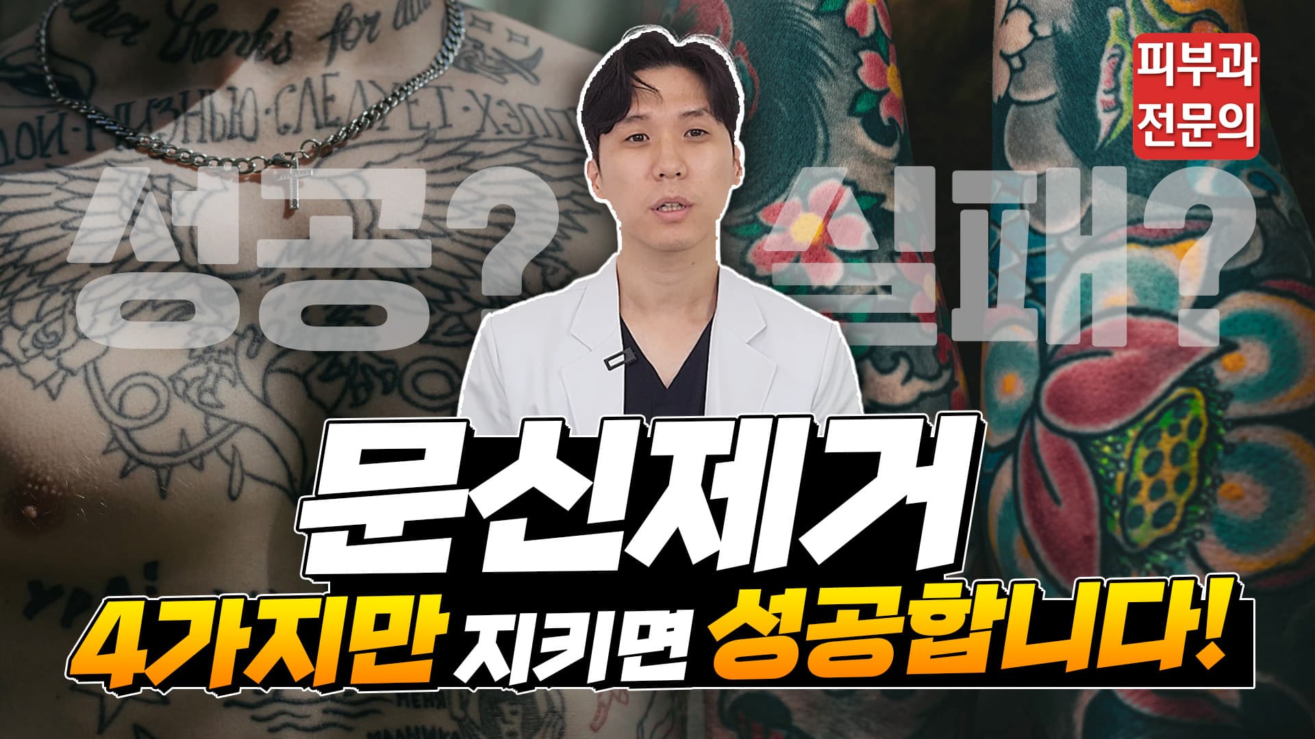 문신제거를 끝까지 완주하게 만드는 네 가지 조건