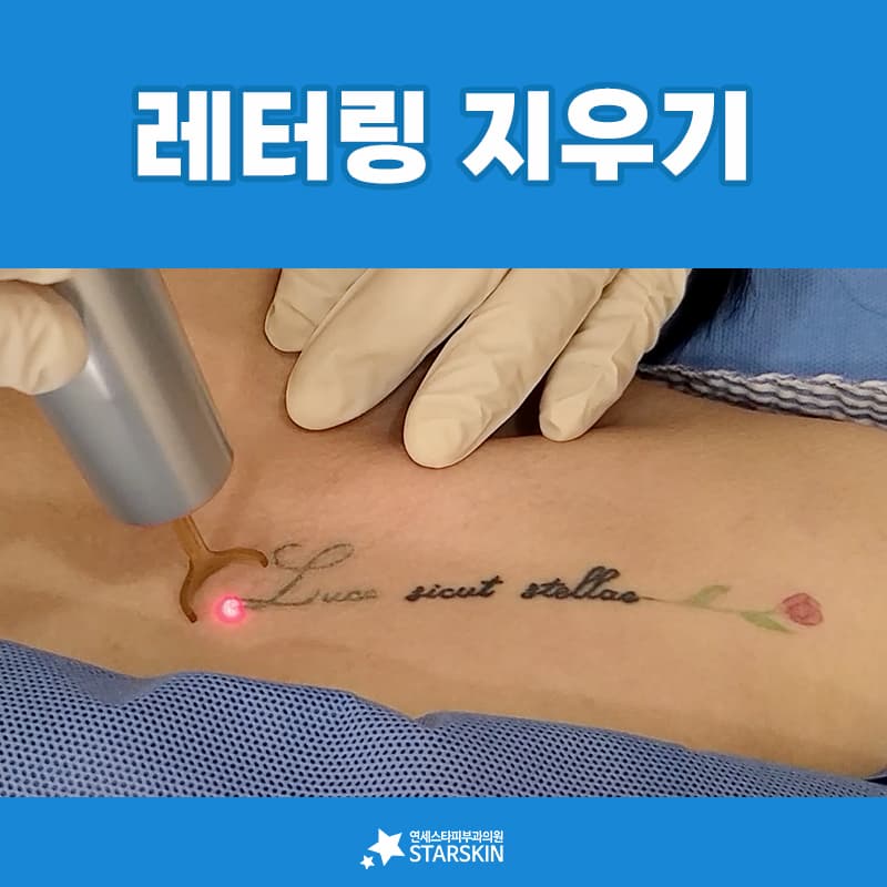 보이는 것보다 많은 색소가 들어 있는 레터링 타투