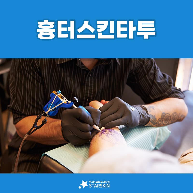 흉터 위에 덮은 스킨 타투는 결국 두 번의 치료가 됩니다