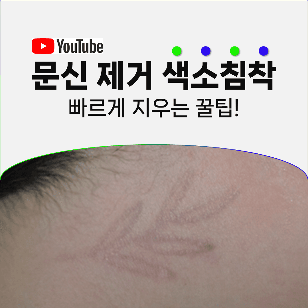 레이저에 더 이상 반응하지 않는 갈색 자국이 남았다면