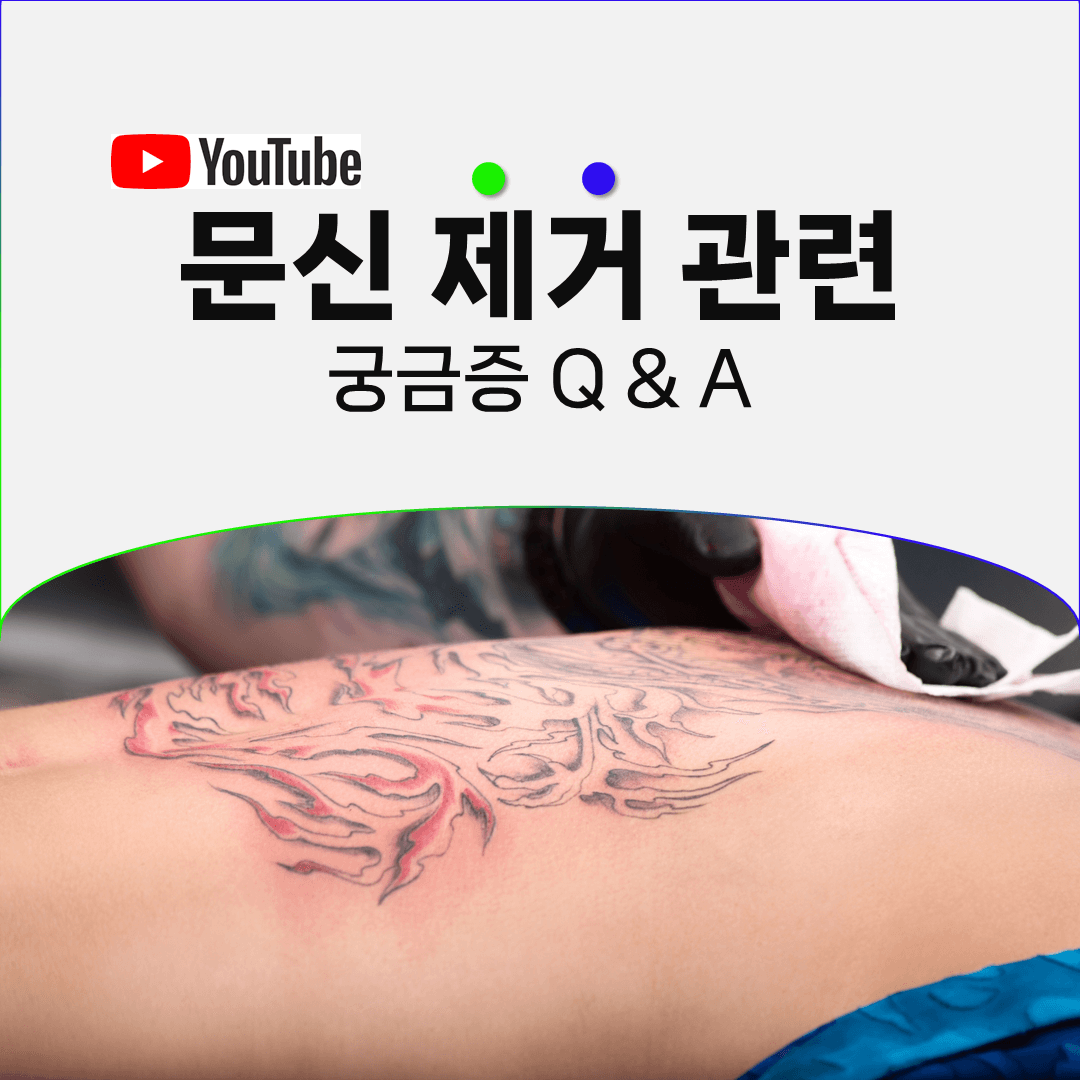 녹색 문신이 마지막까지 애를 먹이는 이유