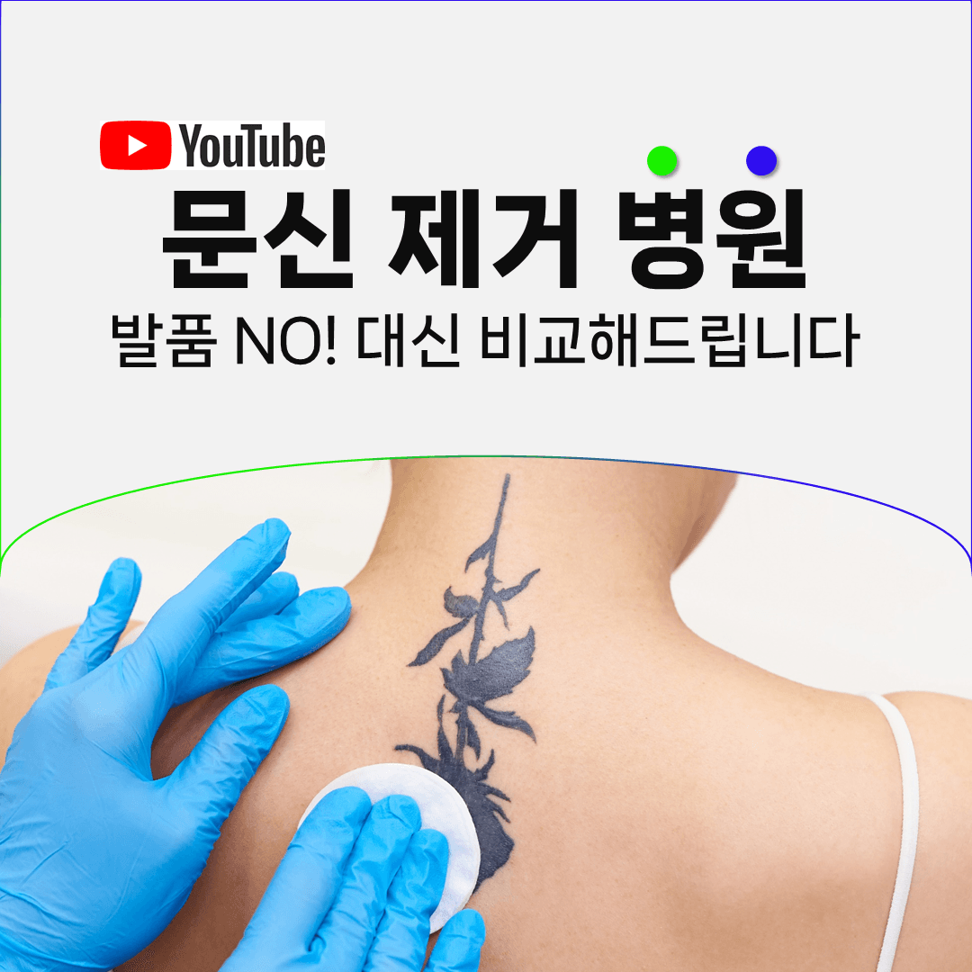 문신제거 병원 비교, 장비와 시술법에서 갈리는 것들