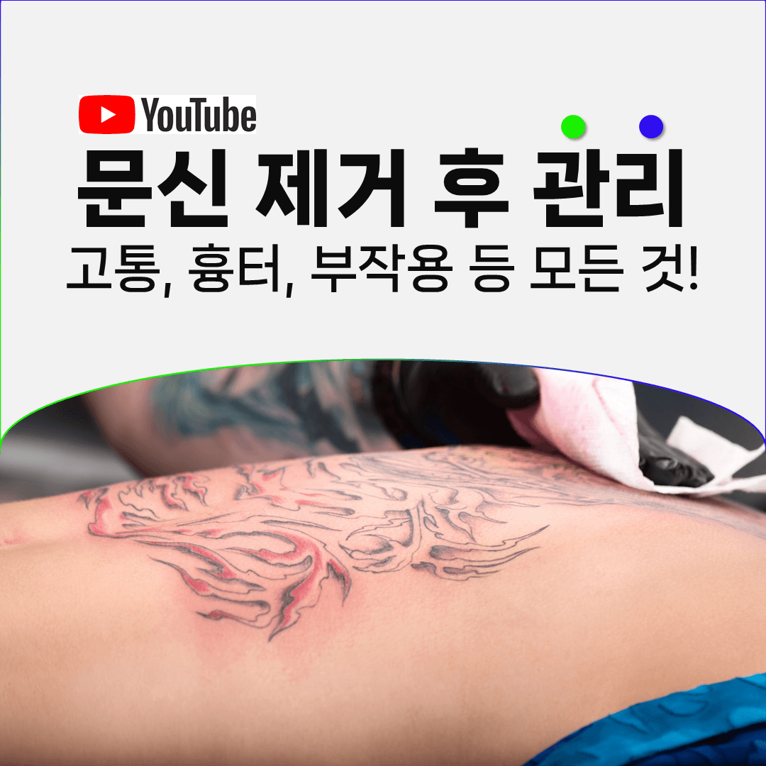여름에도 문신제거를 이어 갈 수 있습니다