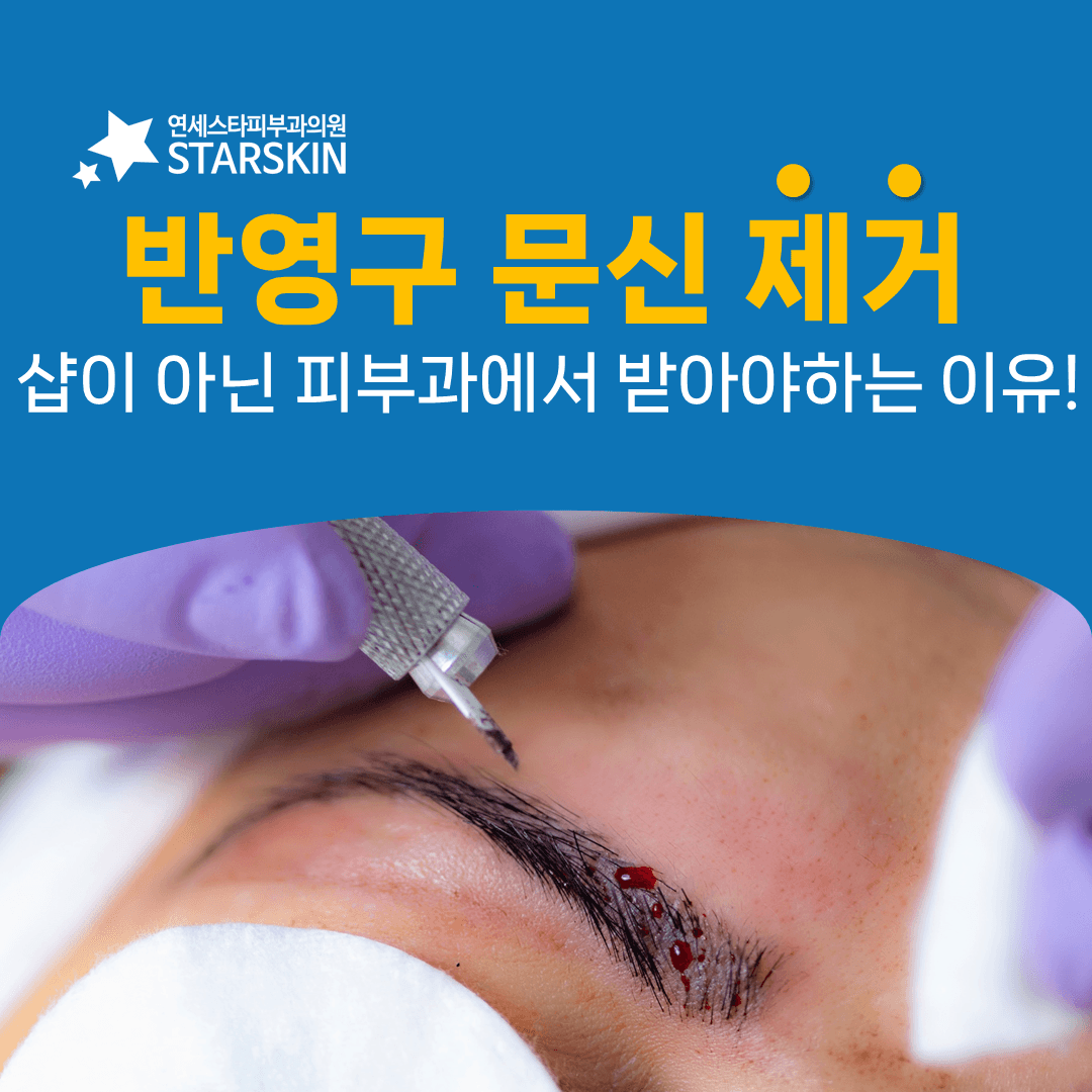 반영구화장 제거 비용을 비교하기 전에 확인할 것