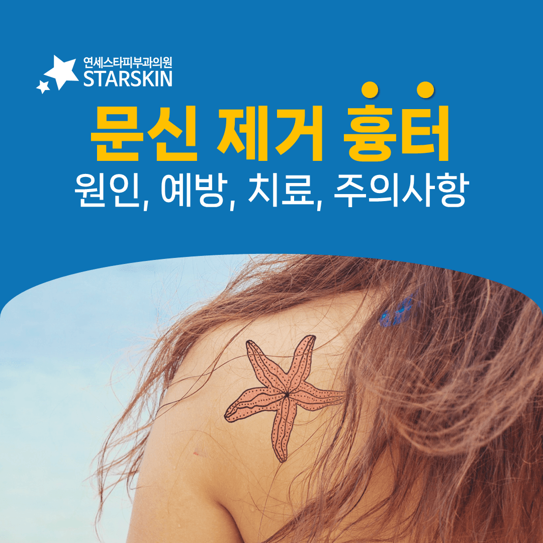 문신제거 흉터가 생기는 이유와 회복기 관리