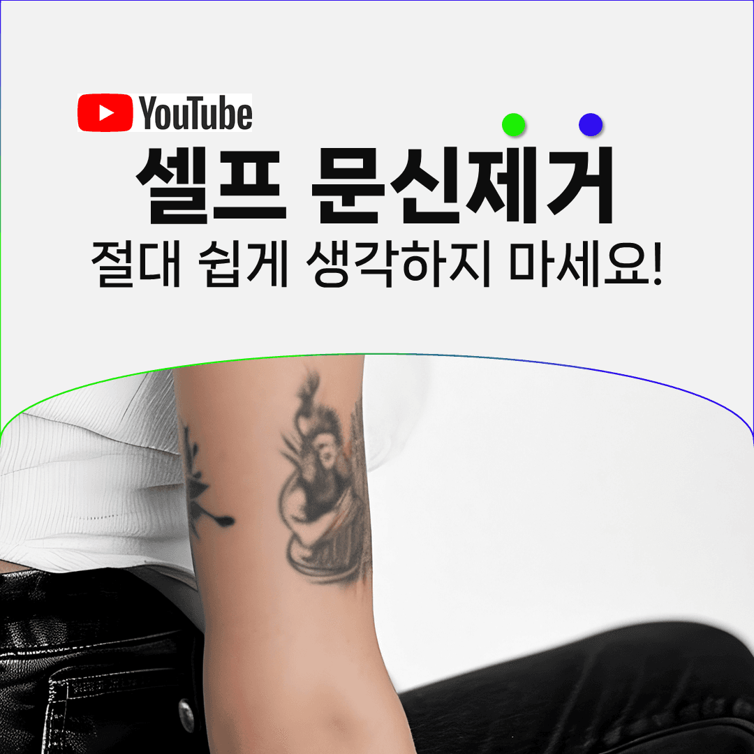 무허가 샵과 집에서의 셀프 타투제거, 그 뒤에 남는 문제