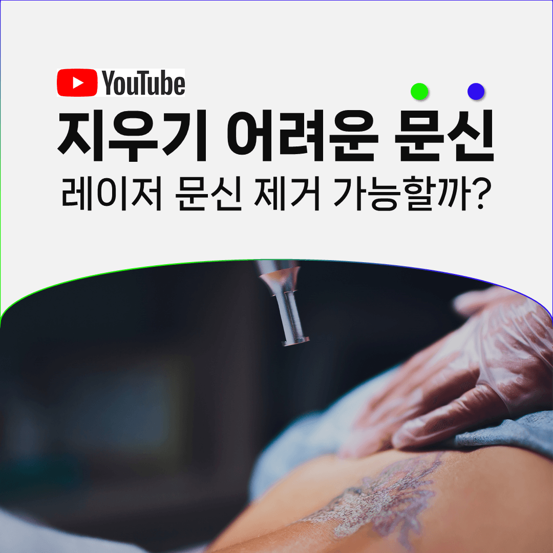 커버업과 살색 문신, 제거가 까다로운 케이스들