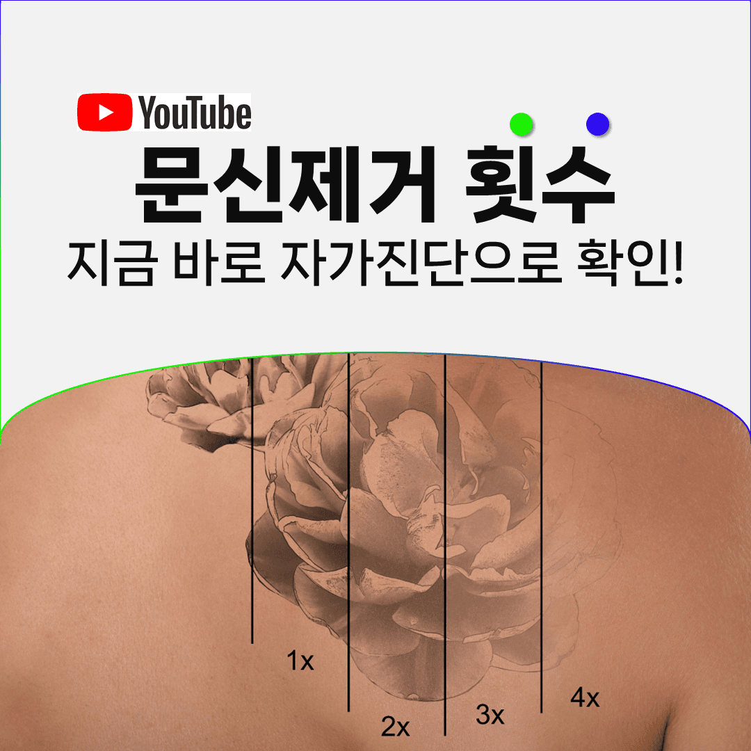 피부색과 위치, 색상에 점수를 매겨 보는 문신제거 횟수 자가진단