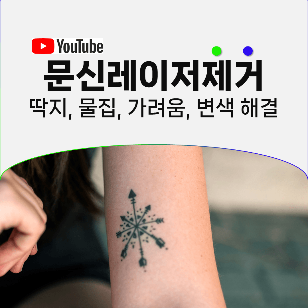 문신 지운 자리에 찾아오는 딱지와 물집, 가려움을 다루는 법