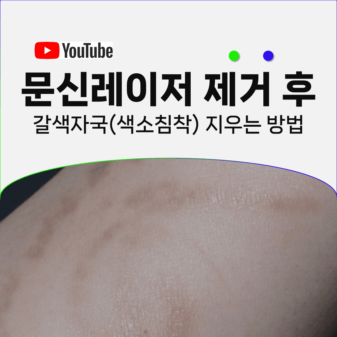 문신을 다 지웠는데 갈색 자국이 남았다면