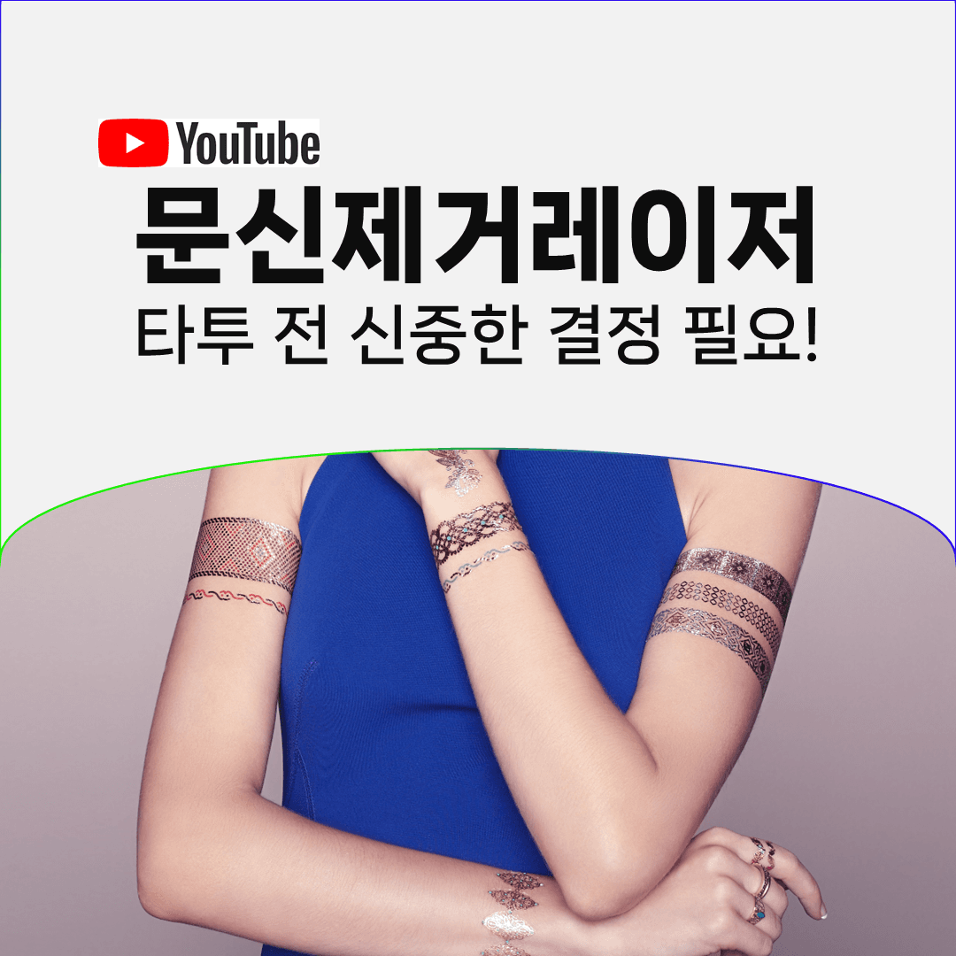 크림부터 피부이식까지, 문신을 지우려던 방법들이 남긴 것
