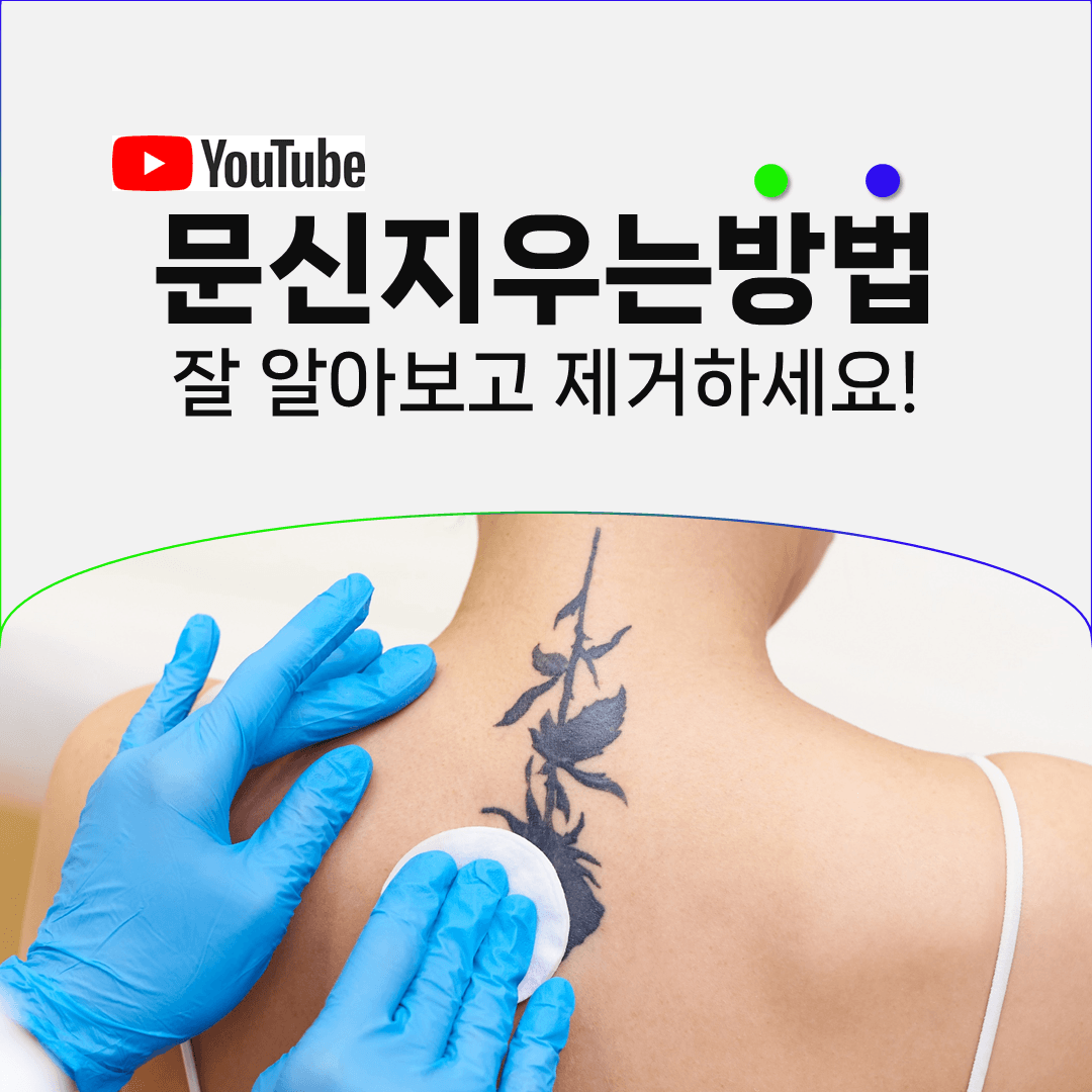 레이저 출력을 높인다고 문신이 빨리 지워지지는 않습니다