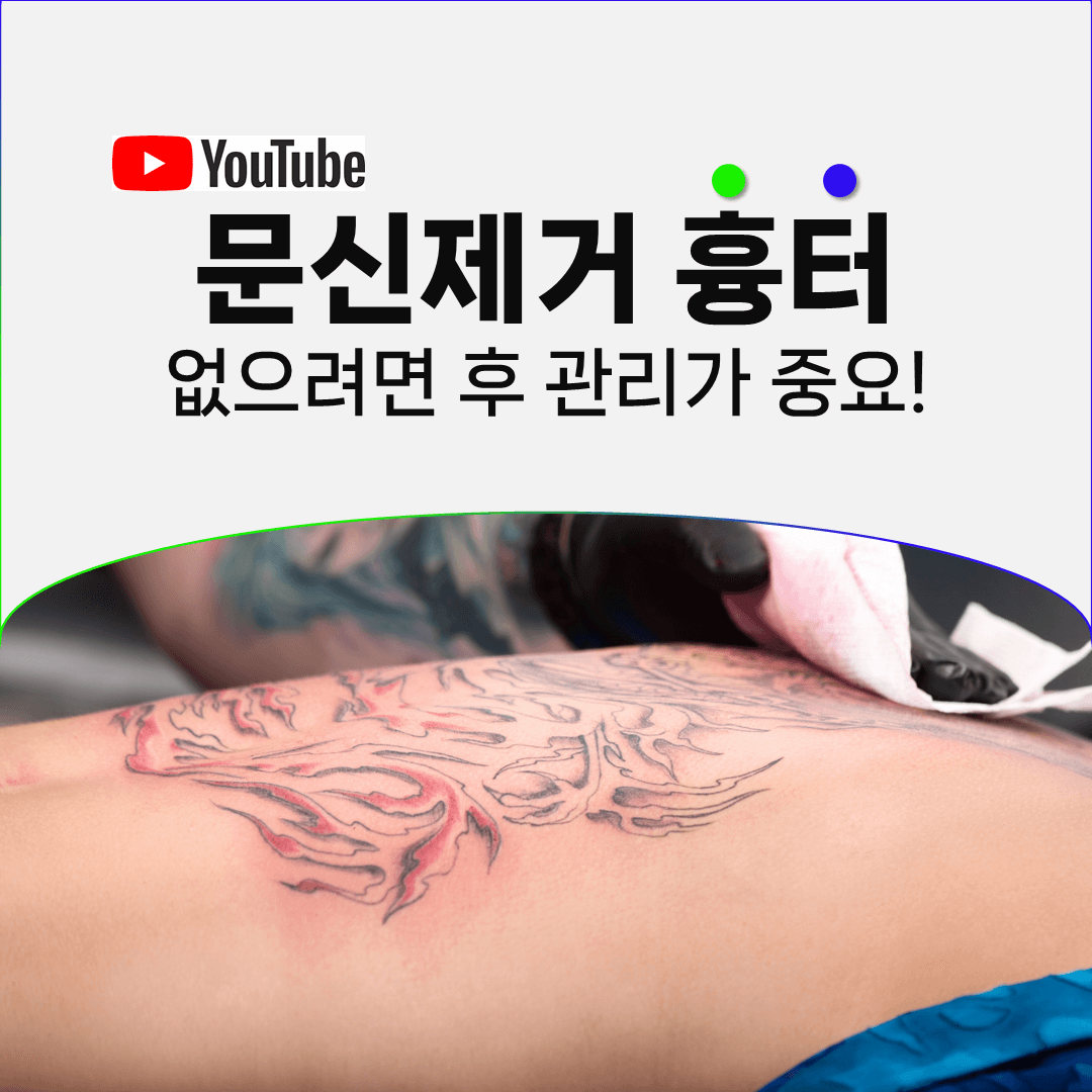 문신제거 후 생기는 진물과 부종을 흉터로 오해하지 않으려면