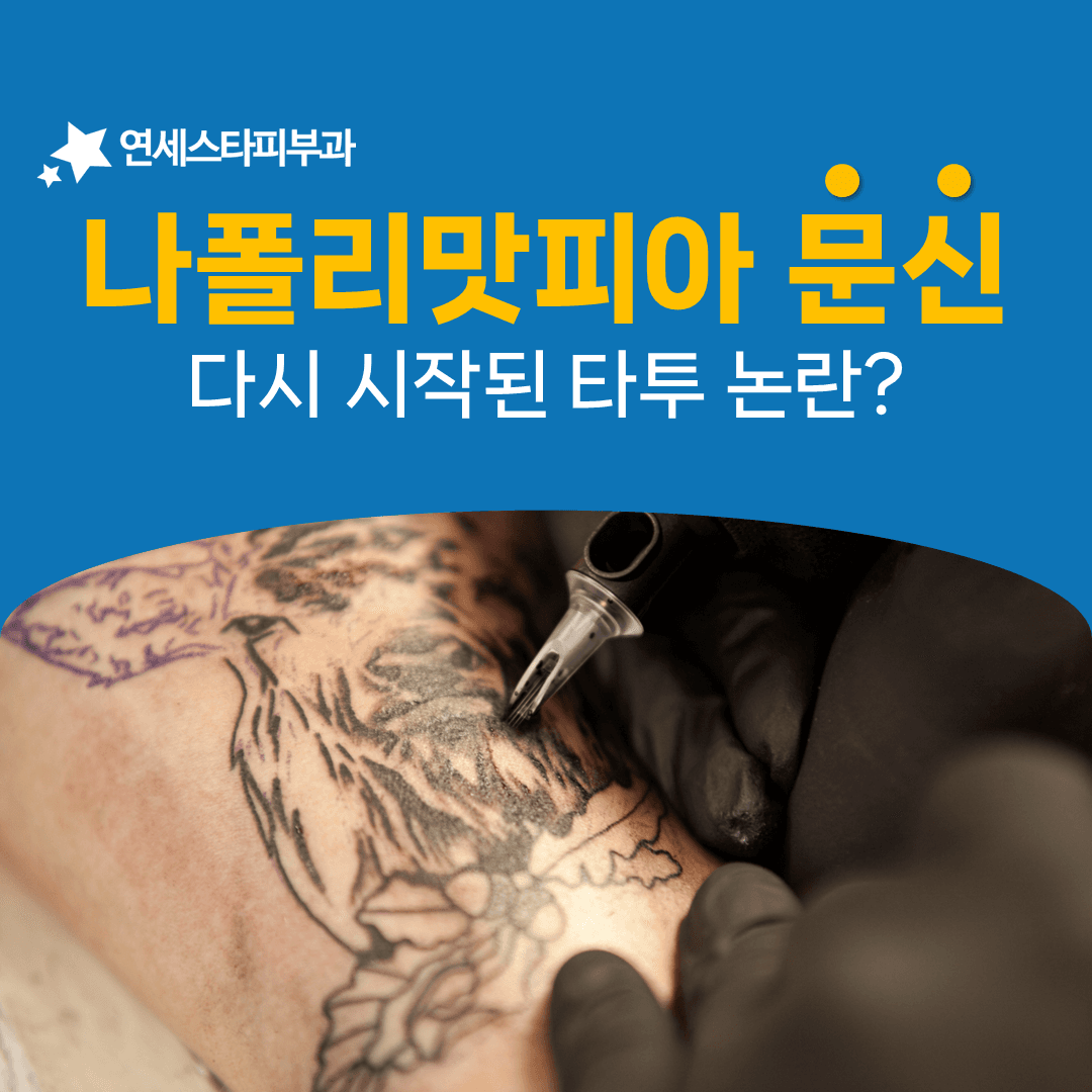 문신을 향한 시선이 갈릴 때 제거를 떠올리게 되는 이유