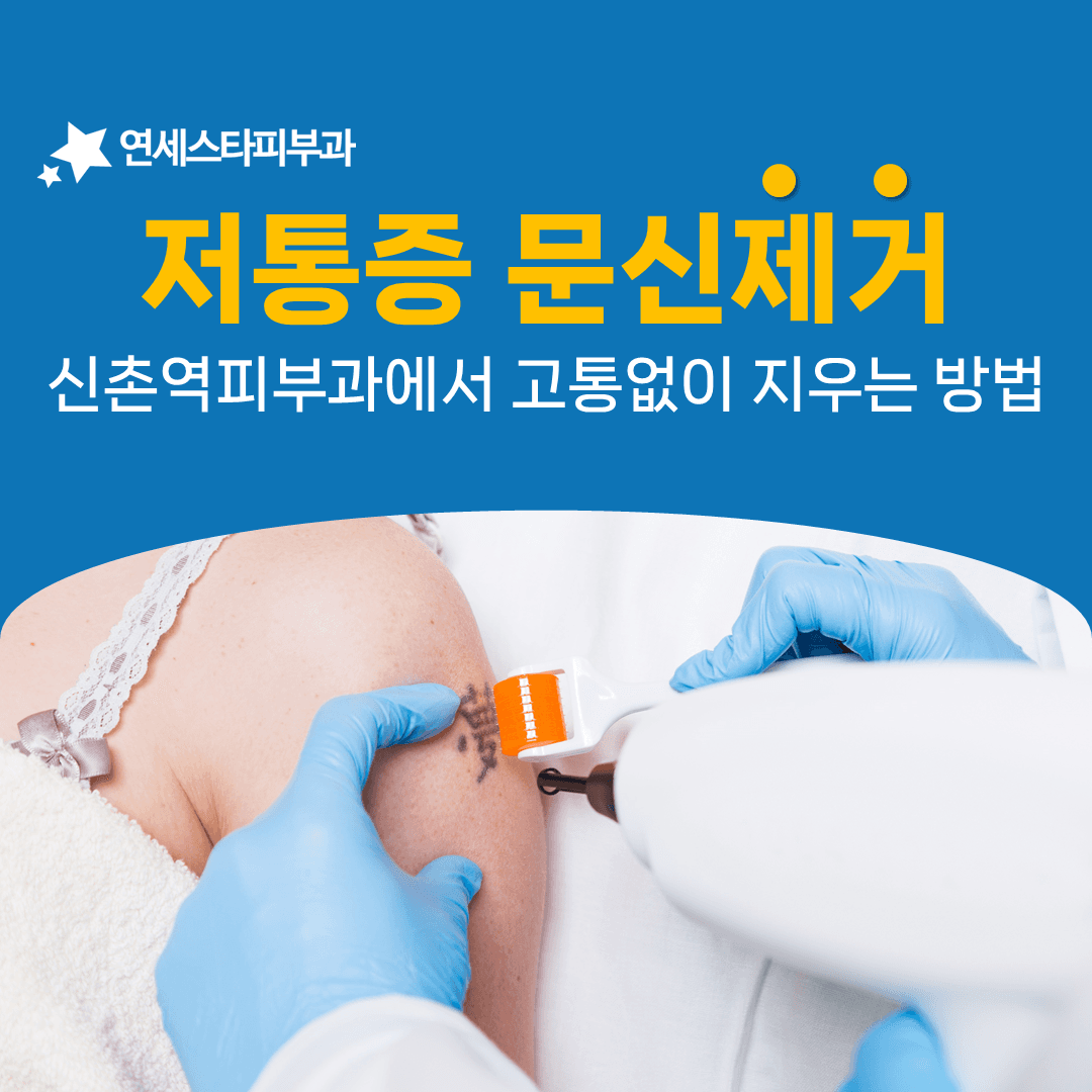 문신제거 통증을 낮추는 세 가지 마취 방식