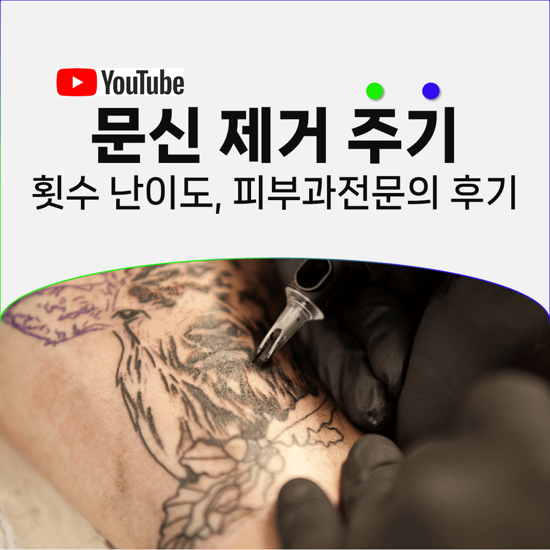지우기 쉬운 문신과 까다로운 문신을 가르는 조건