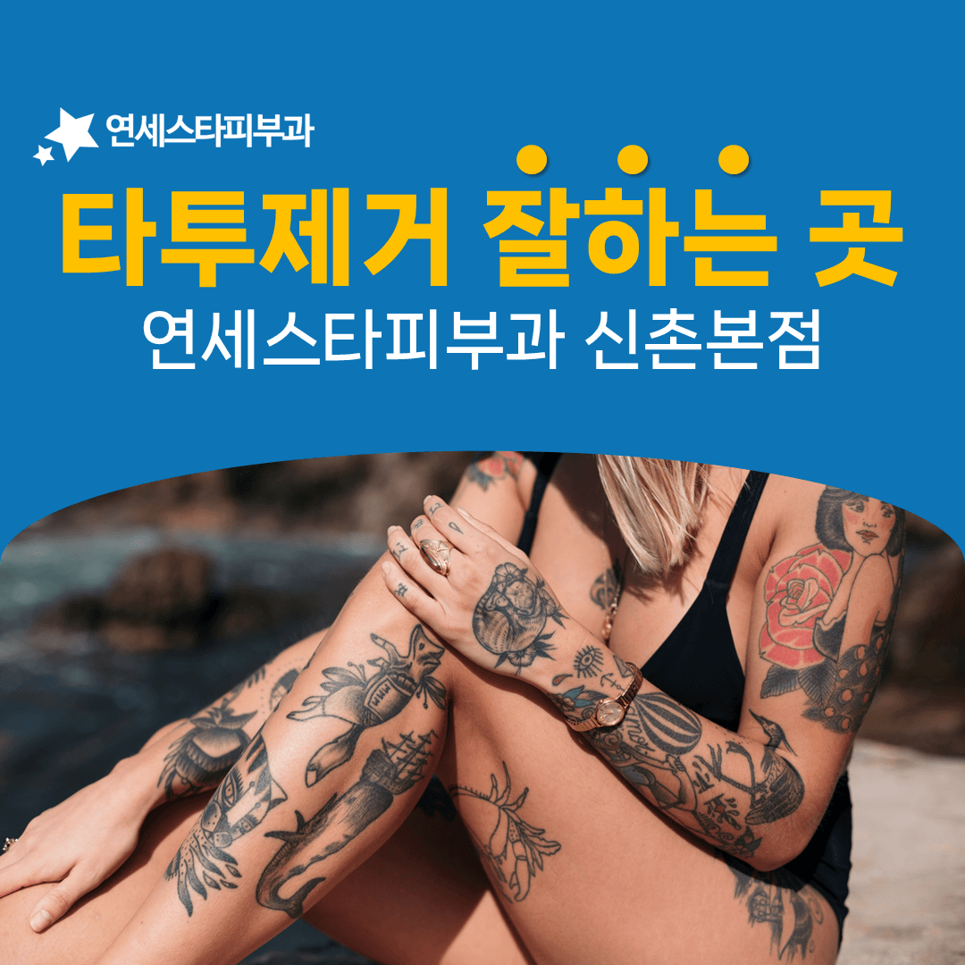 문신을 새긴 직후에도 제거를 시작할 수 있습니다