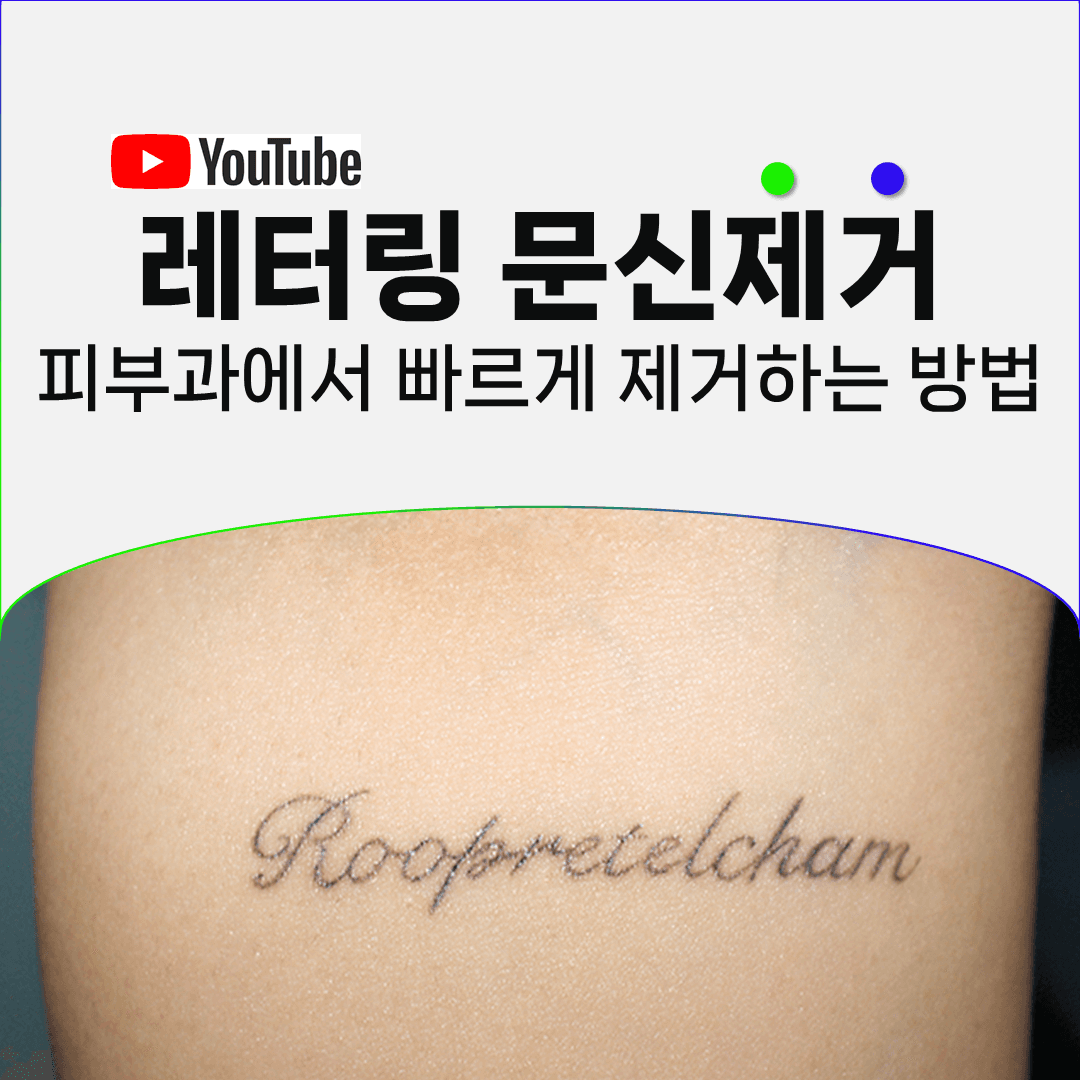 레터링 문신을 지울 때 레이저가 더 들어가지 않는 순간