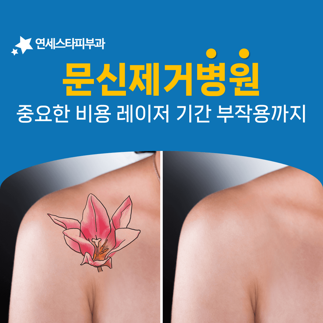 문신제거 기간이 한두 달에서 2년까지 벌어지는 까닭