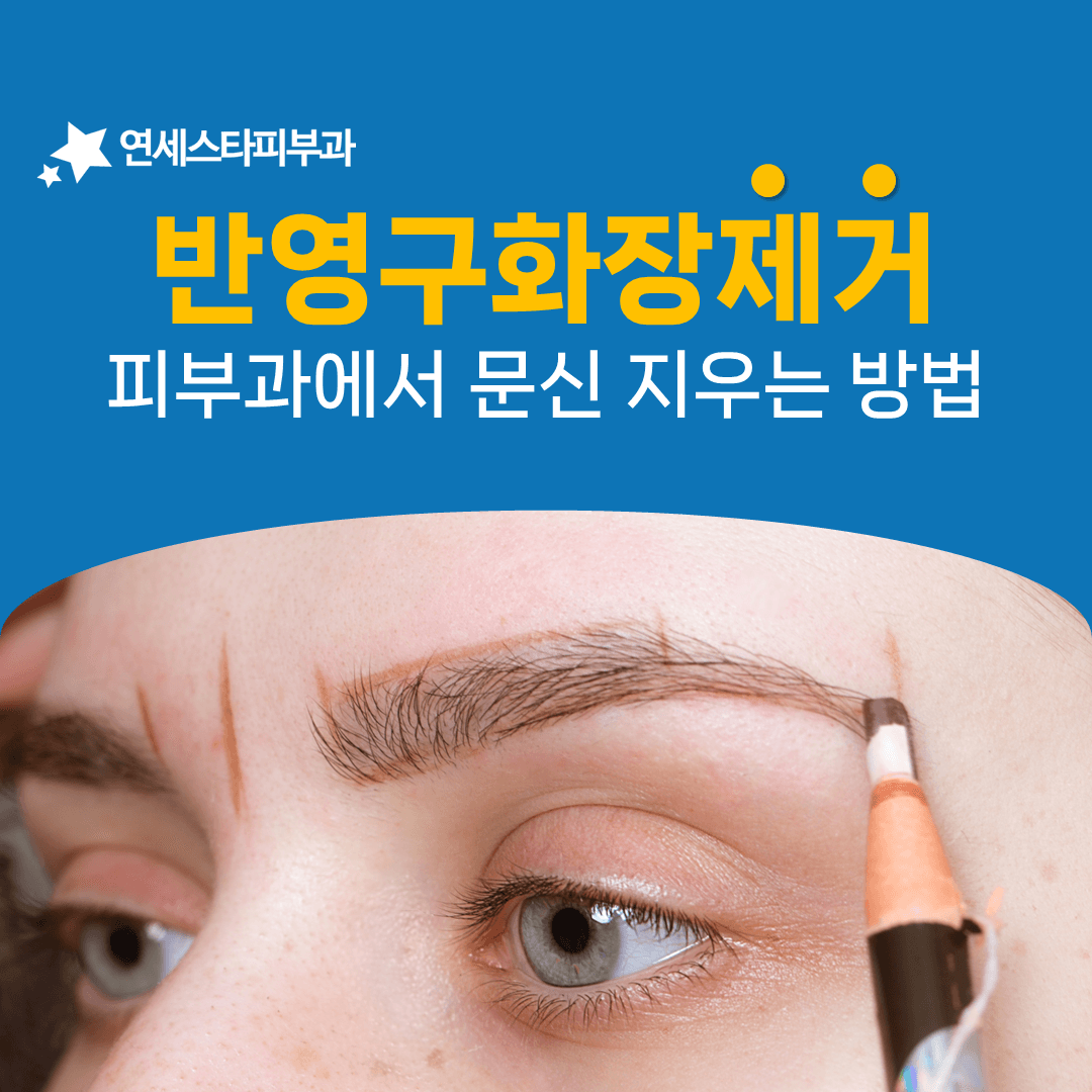 눈썹과 아이라인 반영구 색소를 회차를 나눠 지우는 이유