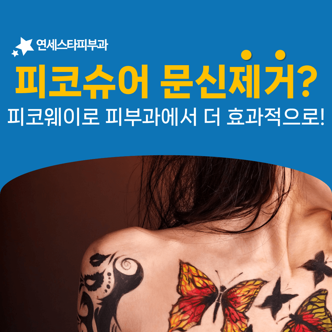 검은 문신과 붉은 문신에 서로 다른 파장을 쓰는 이유