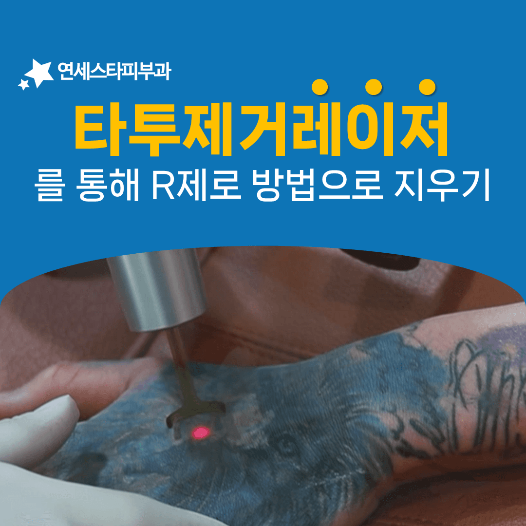 문신제거에 몇 개월이 걸리는지 계산해 보면