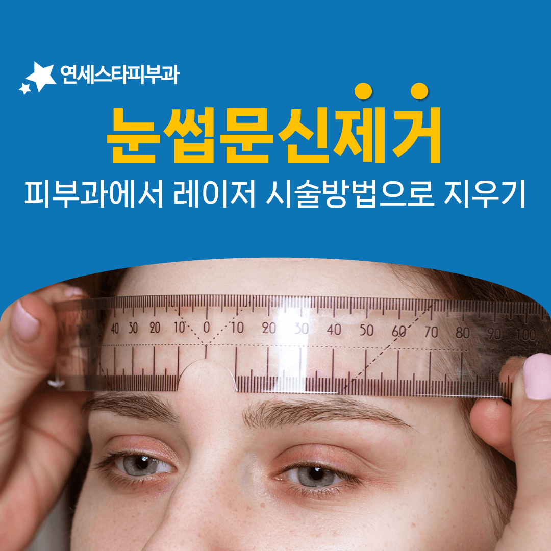눈썹 문신을 지울 때 한 번의 시술을 네 번으로 나누는 방식