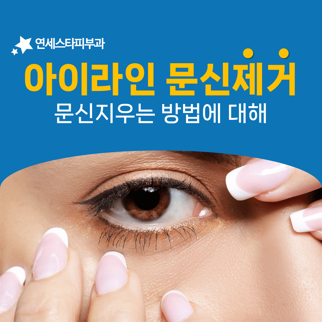 아이라인 문신을 지우기 전 눈을 보호하는 준비 단계