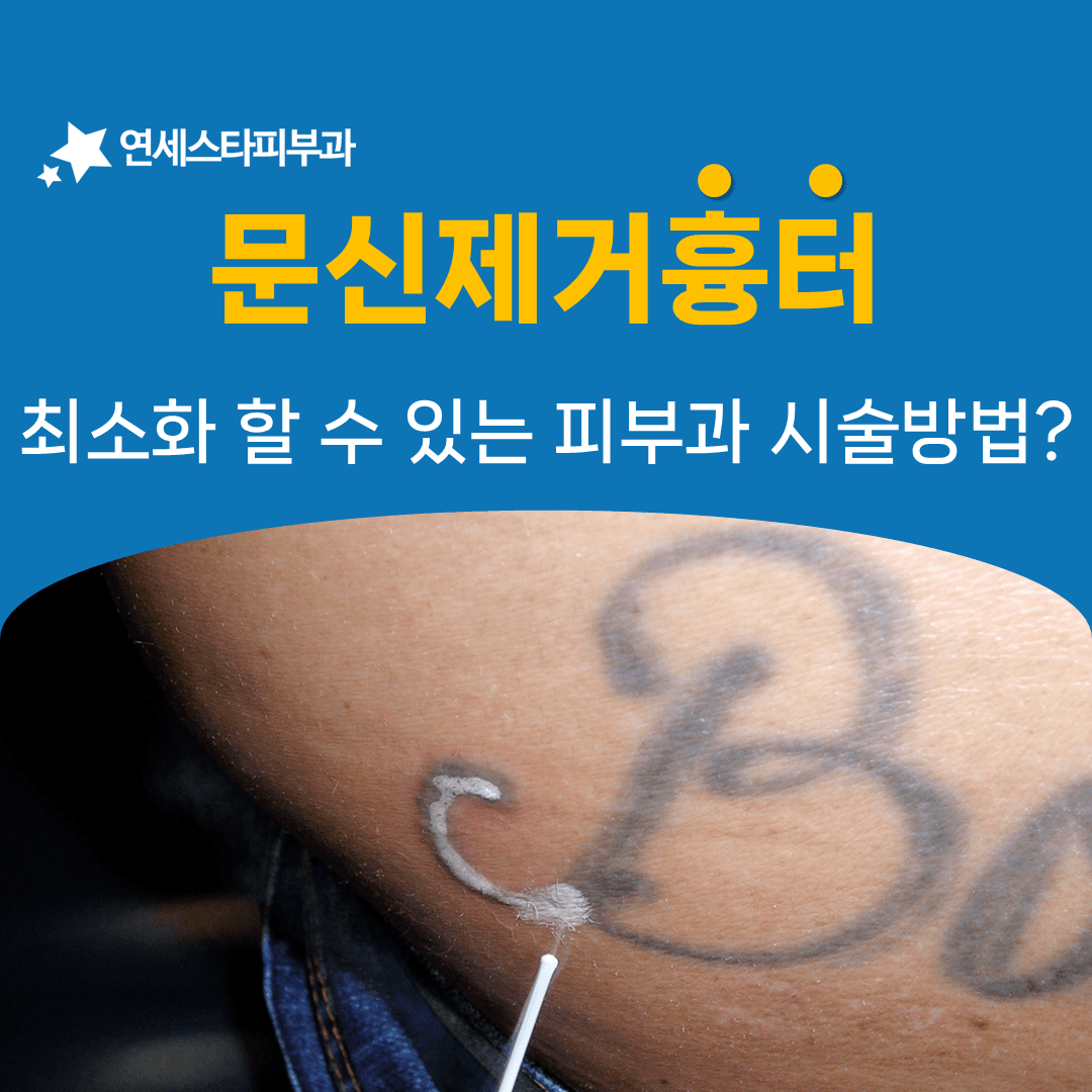 문신제거 마지막 단계에 핀홀법을 더하는 이유