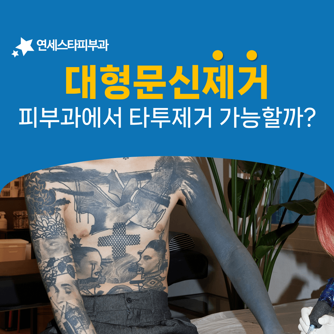 넓은 문신일수록 회차 설계가 중요해집니다