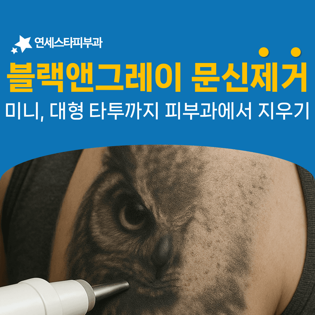 검정과 회색만 쓴 문신이 컬러보다 잘 반응하는 이유