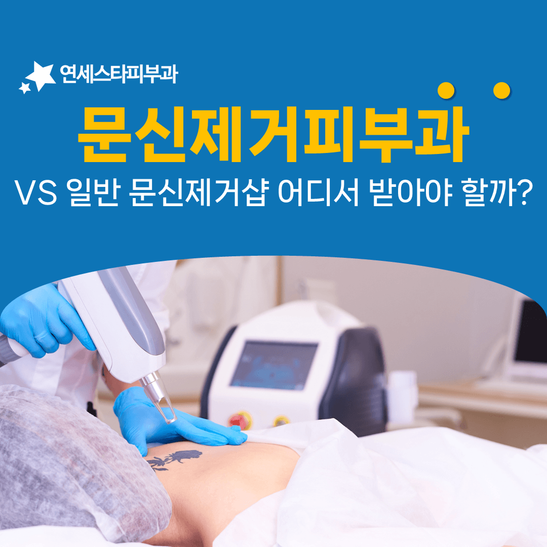 문신제거를 어디서 받을지 정할 때 따져볼 것