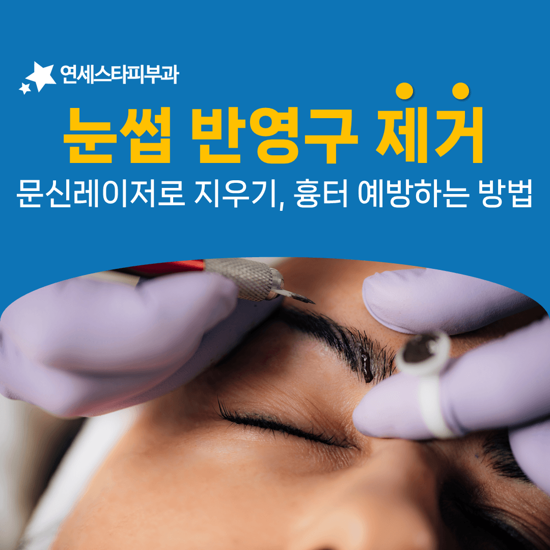 눈썹 반영구 제거가 모근을 함께 살펴야 하는 이유