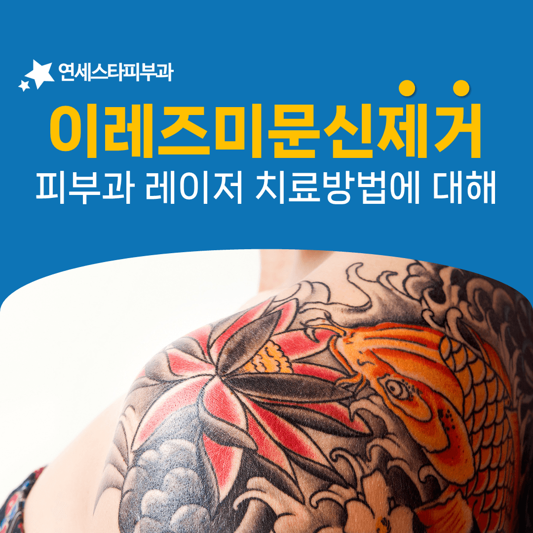 이레즈미 문신이 일반 문신보다 오래 걸리는 조건