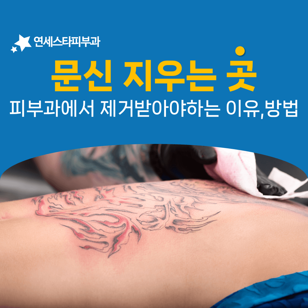 저렴한 가격으로 시작했다가 화상과 색소침착을 안게 되는 경우